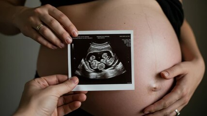 A couple celebrates their pregnancy by showing an ultrasound image of their twins in a warm clinic - Powered by Adobe