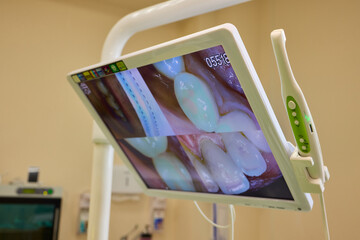Digital Dental Monitor Effectively Displaying Various Oral Health Images Within the Clinic Setting