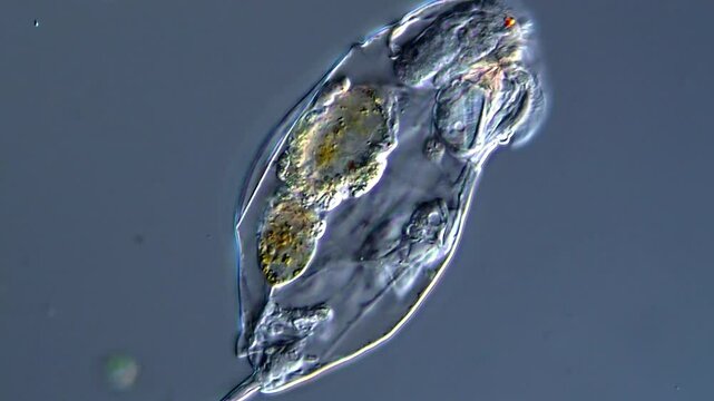 Movement of Rotifer under DIC  microscope view 