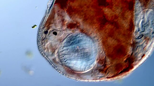 A Turbellarian Flatworm under microscopy view 