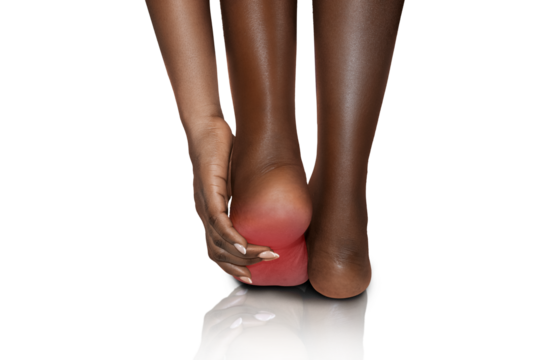 Black Female African woman standing feeling pain in her foot , female suffering from feet ache and using  hand to  massage in other to relax muscle 
