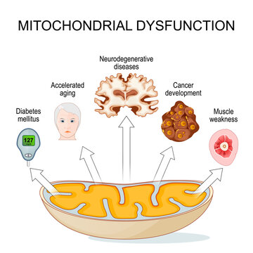 Mitochondrial dysfunction