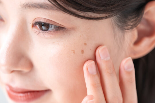 女性　シミ　肌