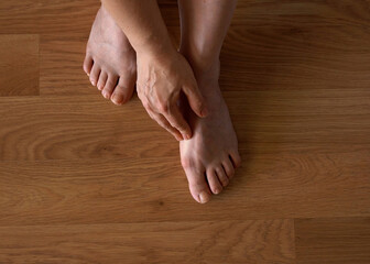 Close-up of a woman s foot with hallux valgus bunion and signs of toenail fungus. Her hand gently...