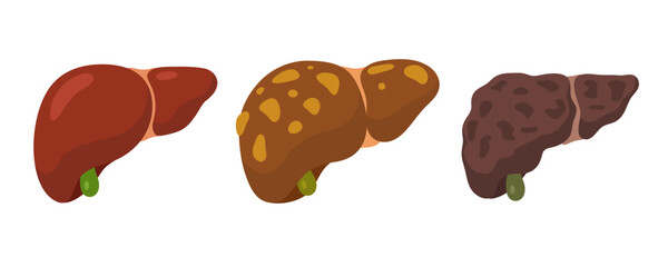 Stylized illustrations of human liver variations