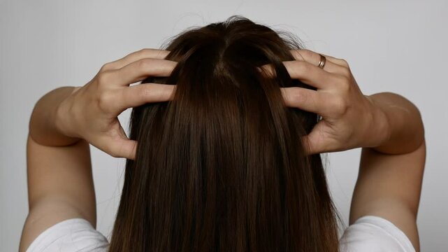 Woman scratching dry scalp with dandruff. Concept of itchy skin, hair problems, and scalp irritation.