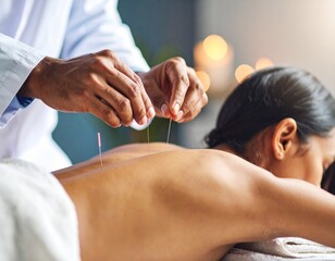 Jeune femme recevant un traitement d'acupuncture. Le médecin enfonce des aiguilles dans le corps de la femme lors de l'acupuncture - gros plan