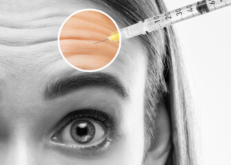 Cosmetologist does prp therapy on the face of a beautiful woman in a beauty salon. Women's...