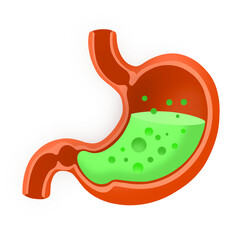Illustration Of Food Poisoning