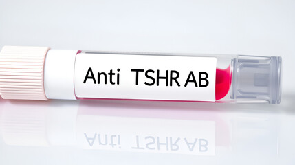 Fototapeta premium Blood sample for Anti TSHR Ab test. Thyroid stimulating Immunoglobulin test. Throtropin binding inhibitory Immunoglobulin.