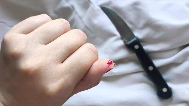 A woman cut her finger with a kitchen knife while cooking. Bleeding from the finger. Blood clotting.