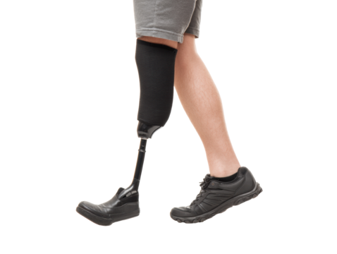 Leg amputation rehabilitation with prosthetic limb for mobility on a transparent background, cut out