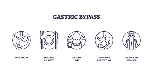 Gastric bypass is illustrated with outline icons showing surgery, dietary change, weight loss, digestive rerouting, and improved health. Outline icons set