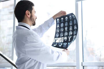 Doctor examining brain MRI scan in clinic