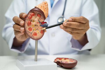 Chronic kidney disease, doctor with model for treatment urinary system, urology, Estimated...
