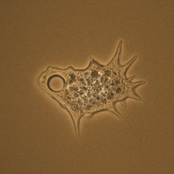 Acanthamoeba castellanii protozoan, highly detailed microscopic image, single-celled organism with spiky pseudopodia, semi-transparent granular body with visible internal structures