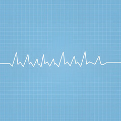 A stylized perspective illustration of an ECG waveform displaying atrial fibrillation, set against a muted blue-gray background with faint grid lines
