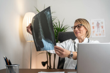 Doctor in office reviewing lung x-ray with satisfaction, observing successful treatment outcome for...