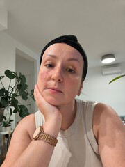 portrait of a woman, without makeup, with a bandage on her head, at home