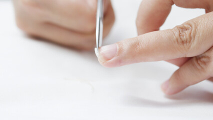 Close up view of a woman skillfully using tweezers to remove a hangnail from her finger, highlighting the importance of nail care and maintaining proper hygiene practices