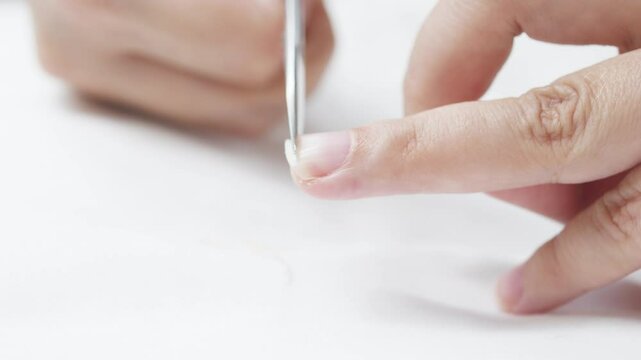 Close up of woman carefully removing hangnail with tweezers, focusing on precise nail grooming and personal hygiene detail