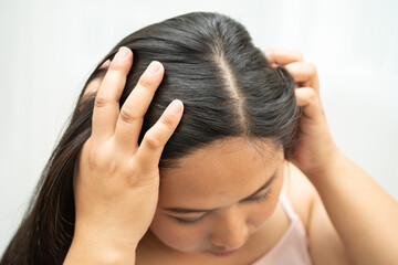 Fototapeta premium Asian women have problems with itchy scalp and dandruff.