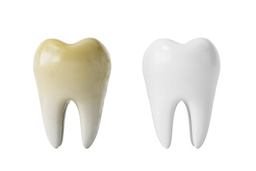 Two teeth side by side, one yellowed and one clean white, realistic 3D rendering style on isolated white background, concept of oral hygiene and whitening