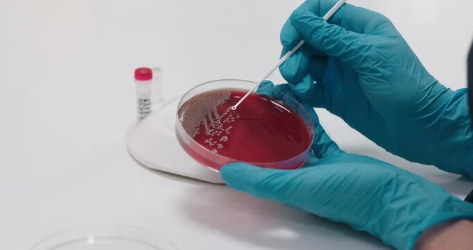 A microbiologist manually handles a Petri dish with an inoculating loop in the laboratory. Concept meticulous study of microorganisms using precise laboratory tools.