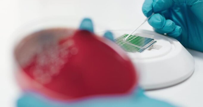Bacterial colonies ferment lactose on MacConkey agar in the microbiology laboratory during an experiment. Concept studying and diagnosing intestinal infections using specialized culture media.