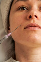 young woman receiving a cosmetic lips injection from a medical professional 