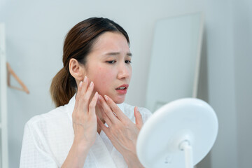 Woman worried about face Dermatology, rosacea dermatitis, allergic steroids, sensitive skin, red face from sunburn, acne, dry skin, large pores ,rash face, dull, freckles, wrinkle, skin problem, .