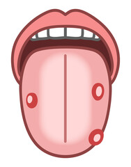 口内炎ができた舌、舌診、病的な舌のイラスト