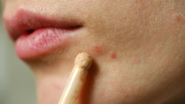 Close-up female applying concealer cover acne problem spots. Make up process blends foundation over red blemishes, transforming problem skin flawless makeup finish. Problem skin acne makeup concealer