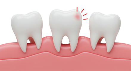 Isolated Tooth Decay in Gums