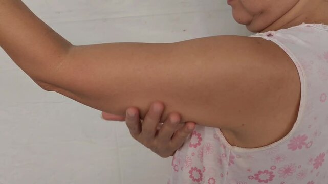 woman with dullness and scar, cellulite and loose, overweight and wrinkle under the arm, Flabby skin and creases, Flabbiness and sagging on the body, health care and beauty concept.