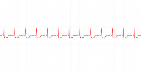 Electrocardiography heartbeat line monitor. Ecg