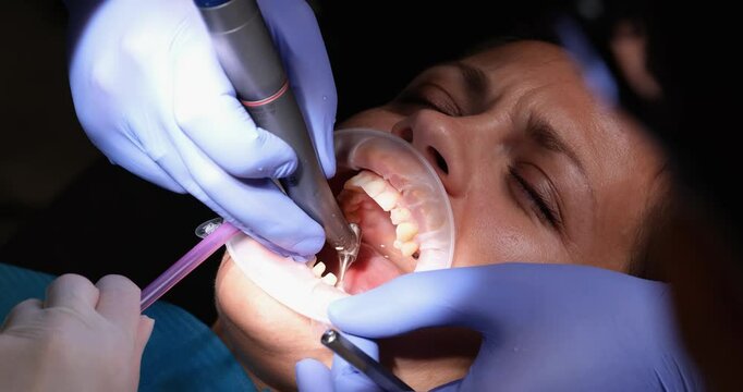 Dentist drills woman teeth with high speed hand piece at treatment in clinic. Nervous patient with cheek retractor and saliva ejector in hospital
