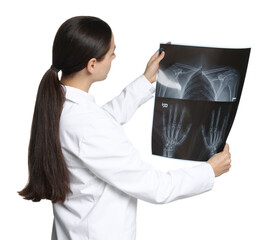 Doctor examining MRI scan on white background