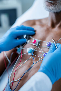 Myocardial infarction cardiac arrest diagnosis recovery. Chest pain treatment. Blood clot medical imaging. Medical staff applying electrodes to a patient's chest.