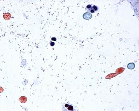 Vaginal smear. Vaginitis