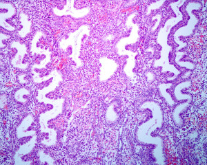 Endometrium. Secretory phase