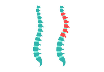 Scoliosis medical poster