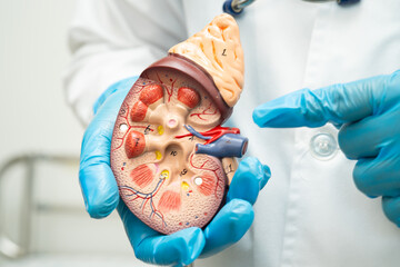 Kidney disease, Chronic kidney disease ckd, Doctor hold human model to treat and study in hospital.