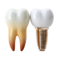 Tooth comparison shows a stained natural tooth alongside a clean, white dental implant on a white background demonstrating modern dentistry progress.