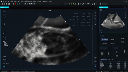 Ultrasound Template with Visible Fetal Movements and Detailed Anatomical Visuals. Screen Replacement for Medical Professional's Computer Display with Sonographic Imaging and Prenatal Diagnostics