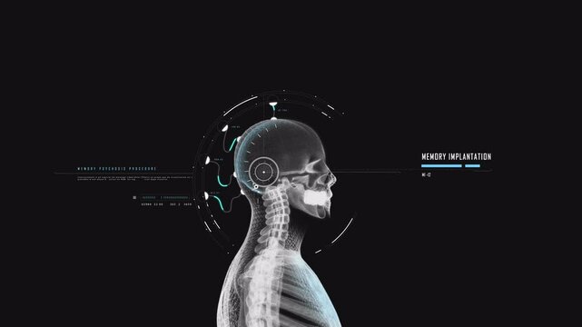 MRA human head brain implant sci fi hud elemnt 