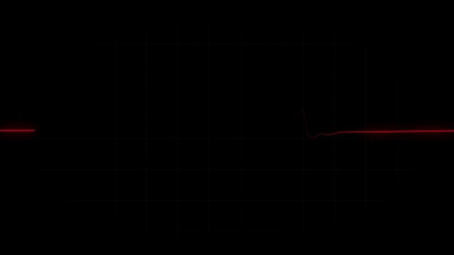 Red EKG flatline. Cardiogram pulse monitor showing heart attack emergency or cardiac arrest. Medical device animation.