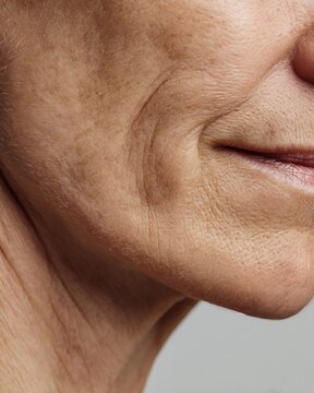Close-up of delicate aging skin texture. Wrinkles, thin skin, and age spots, captured with high clarity.