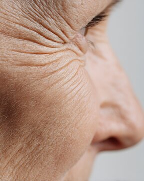 Close-up of delicate aging skin texture. Wrinkles, thin skin, and age spots, captured with high clarity.