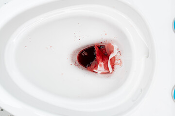 Blood from hemorrhoids or menstruation in the flushed. Clean flush toilet after the stools that are...